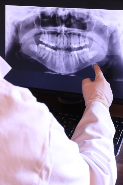 Best Emergency Treatment for Toothache in Willow Creek, CA
